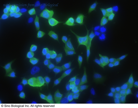 Sino Biological 11203-R004 image 1
