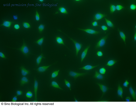 Sino Biological 10426-R110 image 1