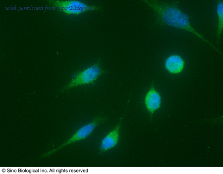 Sino Biological 11013-MM06 image 1