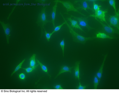 Sino Biological 11280-MM07 image 1