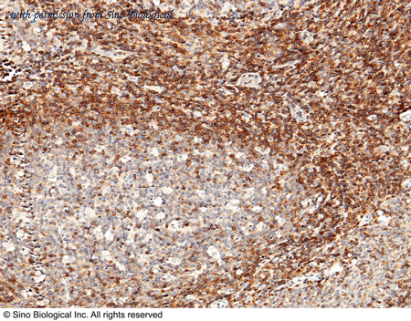 Sino Biological 10944-R505 image 1