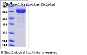 Sino Biological 51122-M08H image 1