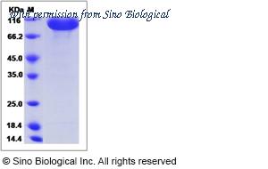 Sino Biological 51367-M02H image 1