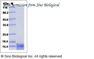 Sino Biological 10899-H08Y image 1