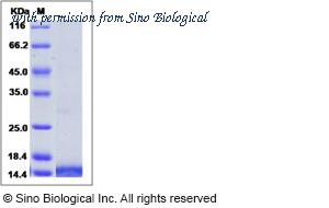 Sino Biological 10491-H07E image 1