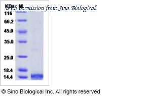 Sino Biological 10491-H08Y image 1