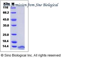 Sino Biological 11292-H08Y image 1