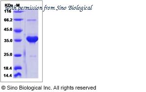 Sino Biological 13442-H05H image 1