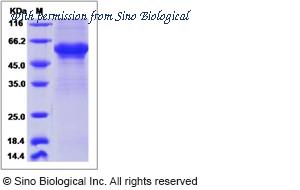 Sino Biological 14574-H05H image 1