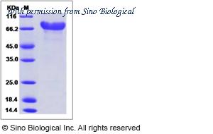 Sino Biological 51138-M02H image 1
