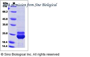 Sino Biological 12259-H07E1 image 1
