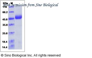 Sino Biological 13686-H08H image 1
