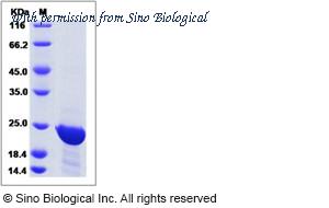 Sino Biological 14968-H07E image 1