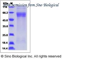 Sino Biological 11229-V08H1 image 1