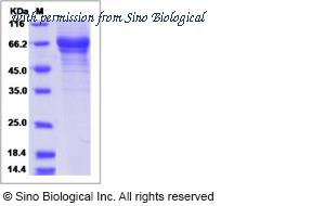 Sino Biological 10424-H08H image 1