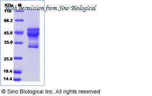 Sino Biological 14613-H04H image 1