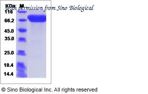 Sino Biological 15169-H02H image 1