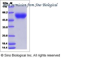 Sino Biological 15169-H08H image 1