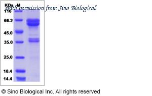 Sino Biological 15944-H02H image 1