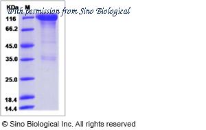 Sino Biological 90295-C02H image 1