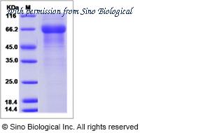 Sino Biological 12343-H02H image 1
