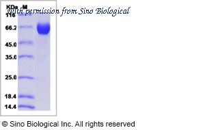 Sino Biological 13482-H02H image 1