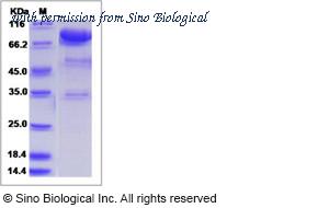 Sino Biological 13606-H02H image 1