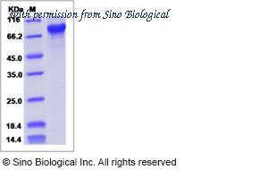 Sino Biological 14543-H20B image 1