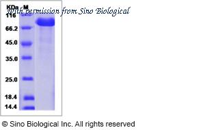 Sino Biological 50405-M02H image 1