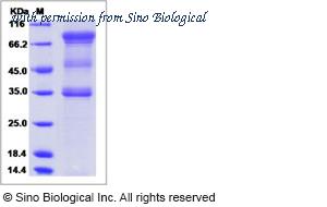Sino Biological 13424-H02H image 1