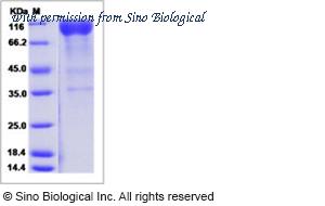 Sino Biological 50282-M01H image 1
