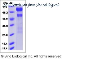 Sino Biological 16138-H08H image 1