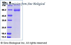 Sino Biological 16138-H02H image 1