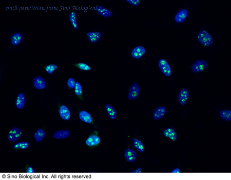 Sino Biological 100130-MM01T image 1