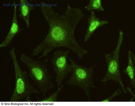 Sino Biological 100302-MM06 image 1