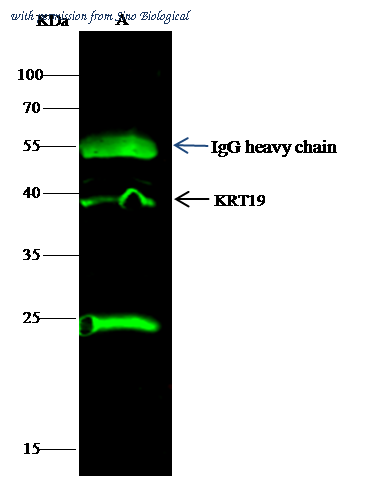 Sino Biological 100306-MM05 image 1