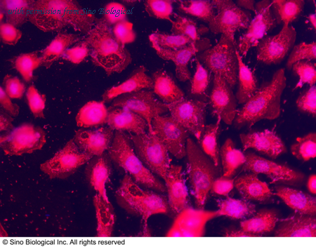 Sino Biological 10046-R390 image 1