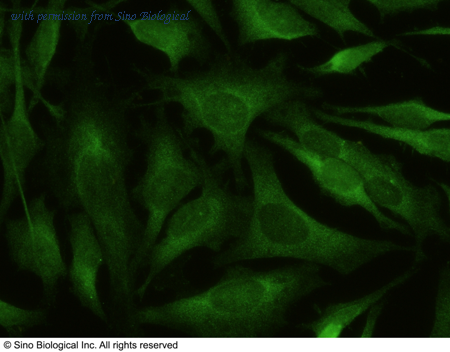 Sino Biological 10064-R027 image 1