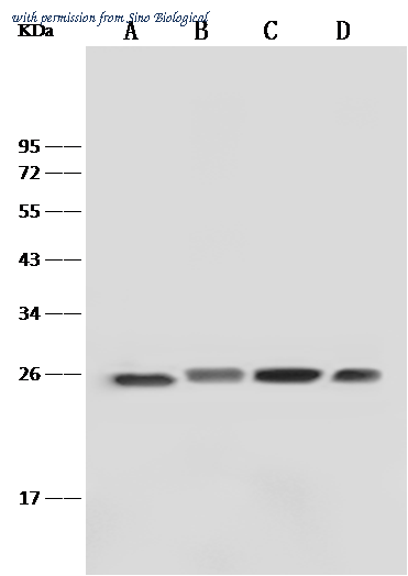Sino Biological 101887-R028 image 1