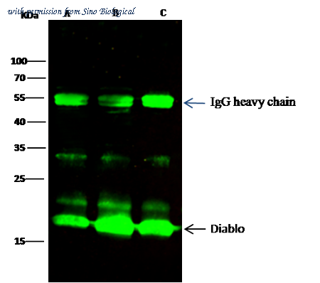 Sino Biological 10339-R001 image 1