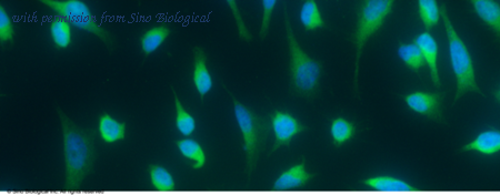 Sino Biological 10527-R007 image 1
