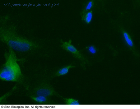 Sino Biological 10700-R116 image 1