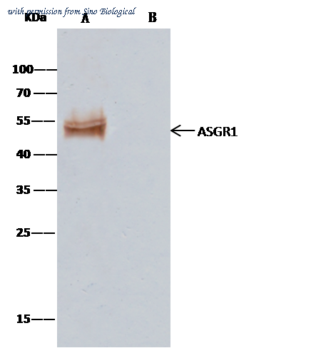 Sino Biological 10773-R021 image 1