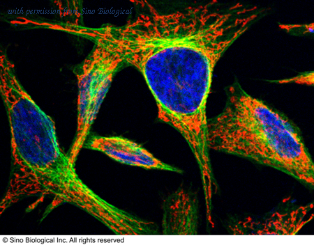 Sino Biological 10924-R026 image 1