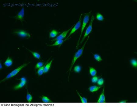 Sino Biological 11183-R004 image 1