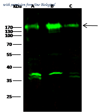 Sino Biological 11183-R019 image 1