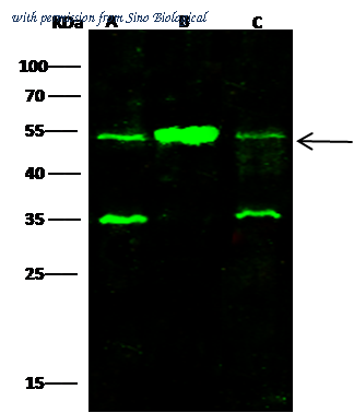 Sino Biological 11209-MM19 image 1