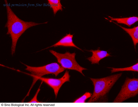 Sino Biological 11615-MM01 image 1