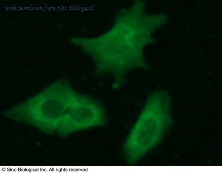 Sino Biological 11927-R021 image 1