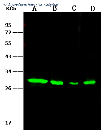 Sino Biological 12046-R002 image 1